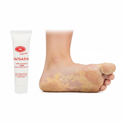 falsches produkt . eine tube mosadal urea creme  nr 139002 von shop2.ch und ein fuss mit viell hornhaut